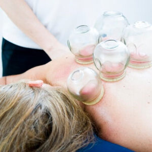 Group logo of Cupping Therapy